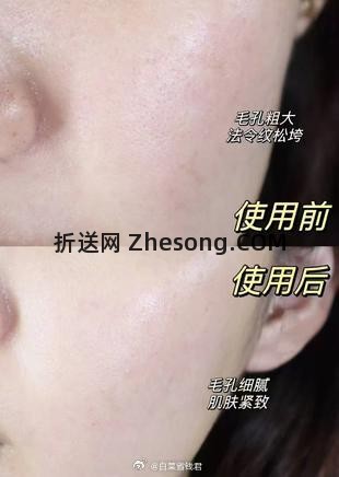 薇诺娜舒敏保湿润肤水90ml拍3件 39.99元 - 折送网